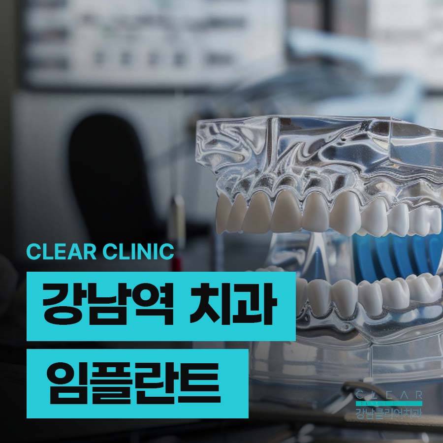 강남역 치과 임플란트 체크해야 할 곳 관련 이미지 1
