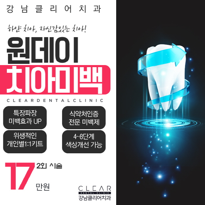 치아브릿지 강남치아브릿지도 이제 맞춤형으로 관련 이미지 12