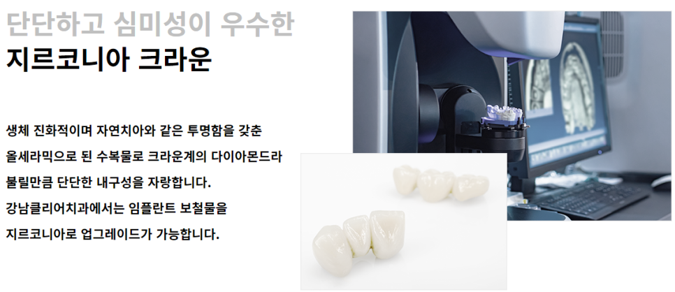 오스템 소이임플란트 합리적 선택해야 할 땐 관련 이미지 9