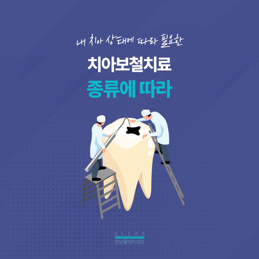 치아보철치료 종류 단계에 따라 관련 이미지 4