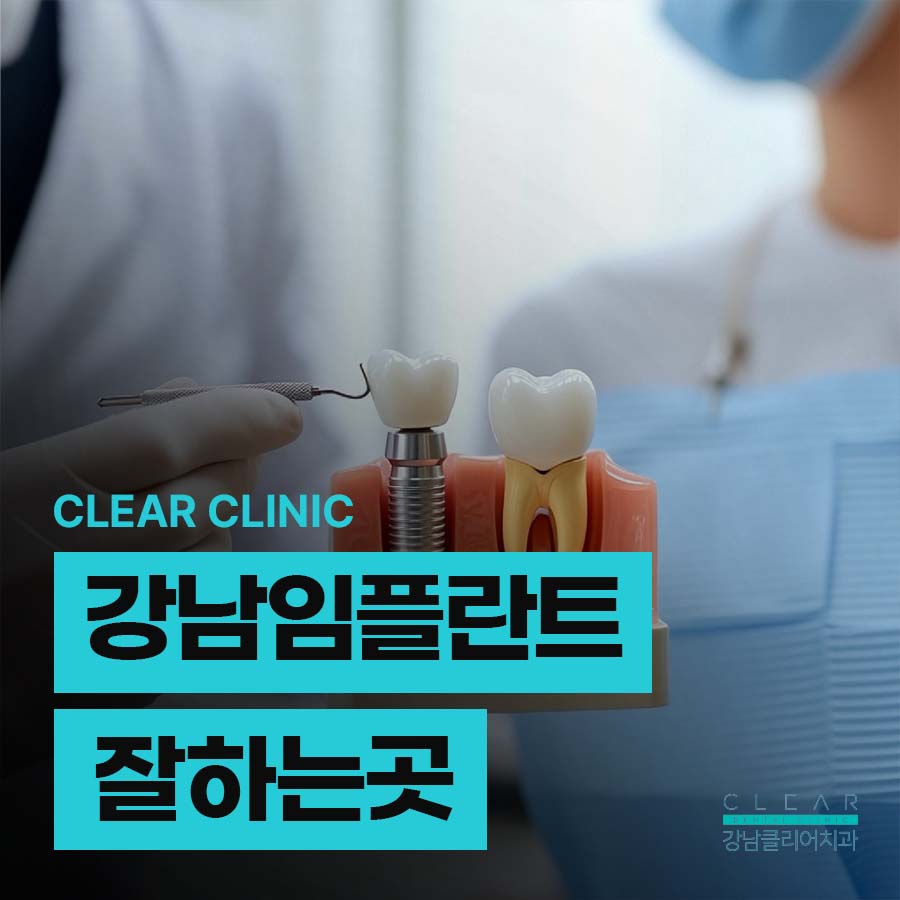 강남 임플란트 잘하는곳 당일 식립 가능하려면 관련 이미지 1