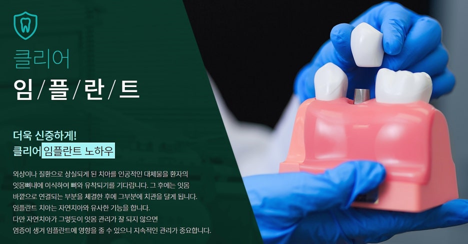 임플란트 실비보험 되는지 모르겠다면? 관련 이미지 2