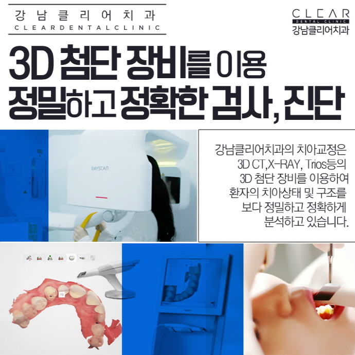 치아브릿지 강남치아브릿지도 이제 맞춤형으로 관련 이미지 6