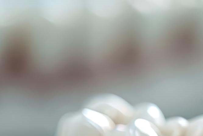 임플란트 구조 수명은 어느정도? 관련 이미지 15