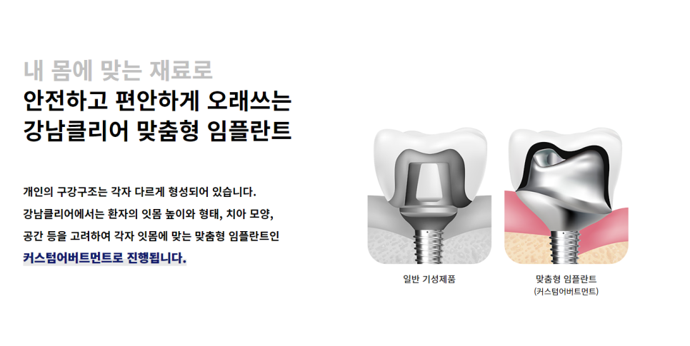 강남 임플란트 남다른 치과에서 관련 이미지 6