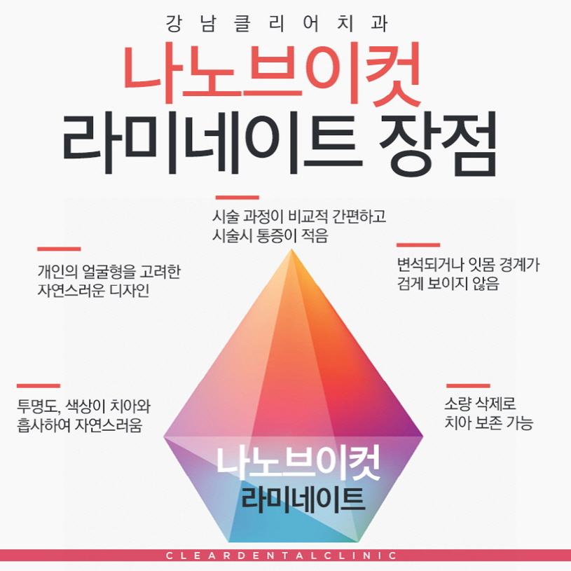 강남역라미네이트 간단히 결정말고 비교하고 따져보세요 관련 이미지 5