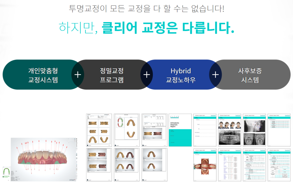 논현동교정치과 나에게 맞는 다양한 방법으로 관련 이미지 6