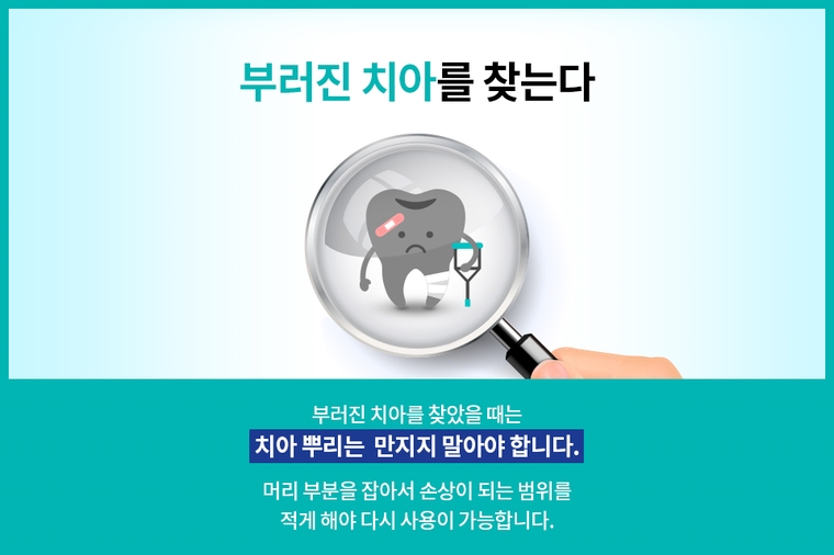 클리어치과와 알아보는 치아가 부러졌을 때 대처법 관련 이미지 3
