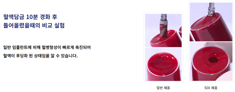 임플란트치과병원 강남 실력좋은 곳 찾는다면 관련 이미지 8