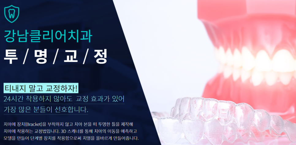 서울치과잘하는곳 찾는다면 투명교정도 함께 알아봐요 관련 이미지 9