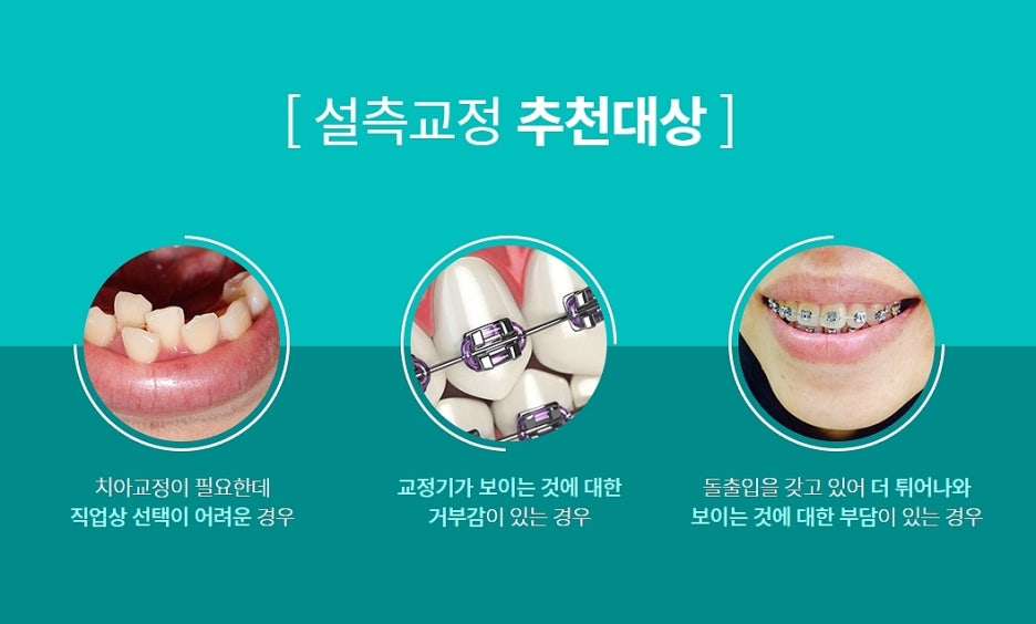 강남 설측교정 할 의향이라면? 관련 이미지 4