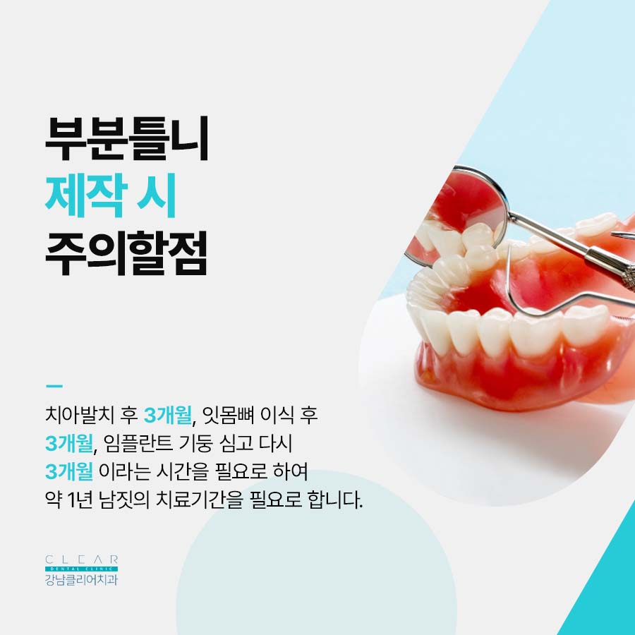 부분틀니 좋은점 및 제작시 주의할점 관련 이미지 3