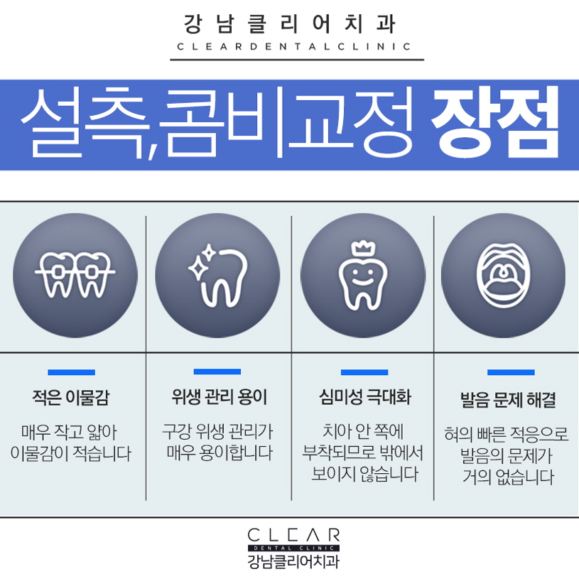 설측교정 교정한거 아무도 몰라요 관련 이미지 5