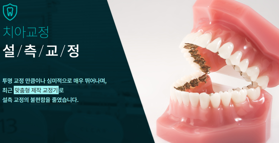 강남치아교정잘하는곳 반듯한 치아로 이미지 개선! 관련 이미지 3