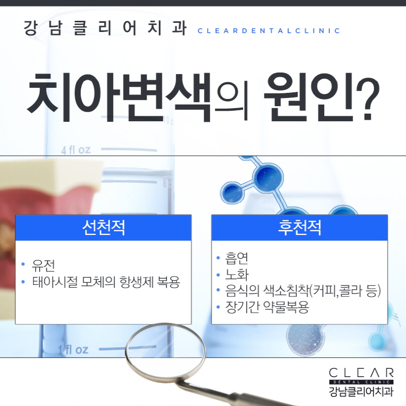 강남역치아미백 간단한 시술로 자신있는 미소를 관련 이미지 3