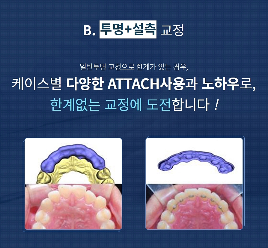 강남역 11번출구 치과 찾아보고 있다면? 관련 이미지 4