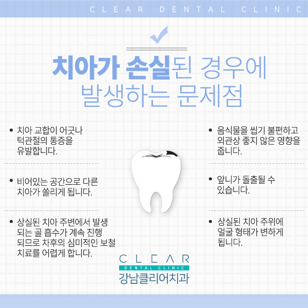 강남역치과 추천 치아 보철치료 관련 이미지 3