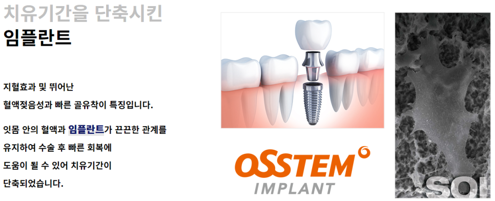 오스템 소이임플란트 합리적 선택해야 할 땐 관련 이미지 6