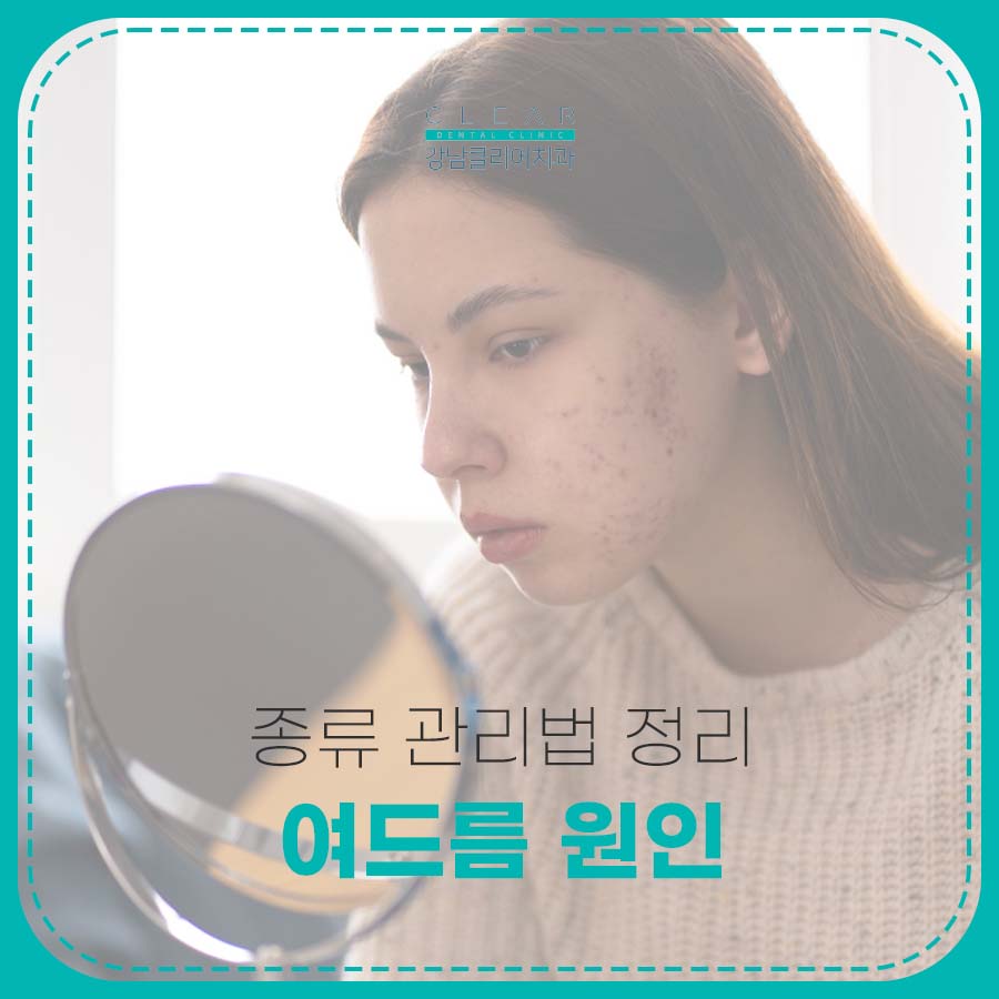 여드름 원인 종류 관리법 정리 관련 이미지 1
