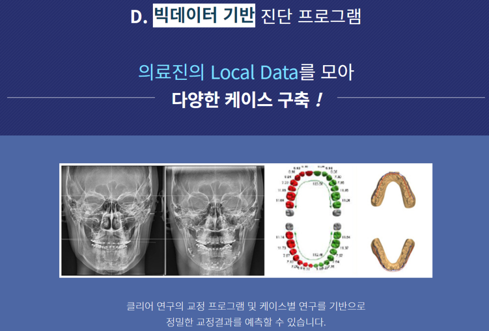 서초동치아교정잘하는곳 심미성까지 생각한다면 관련 이미지 3