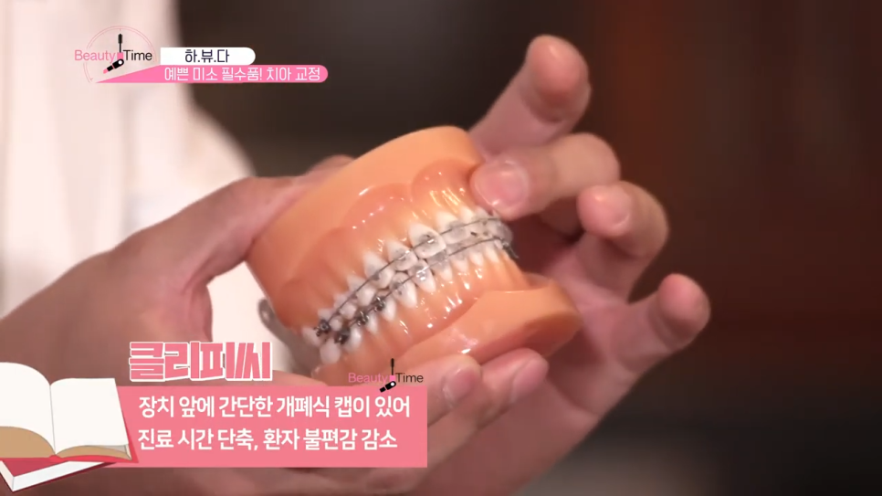 치아교정꿀팁 치아를 반듯하게 강남치과에서! 관련 이미지 10