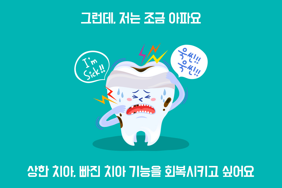 임플란트 - 빠진 치아 자리, 방치하면 안 돼요! 관련 이미지 2