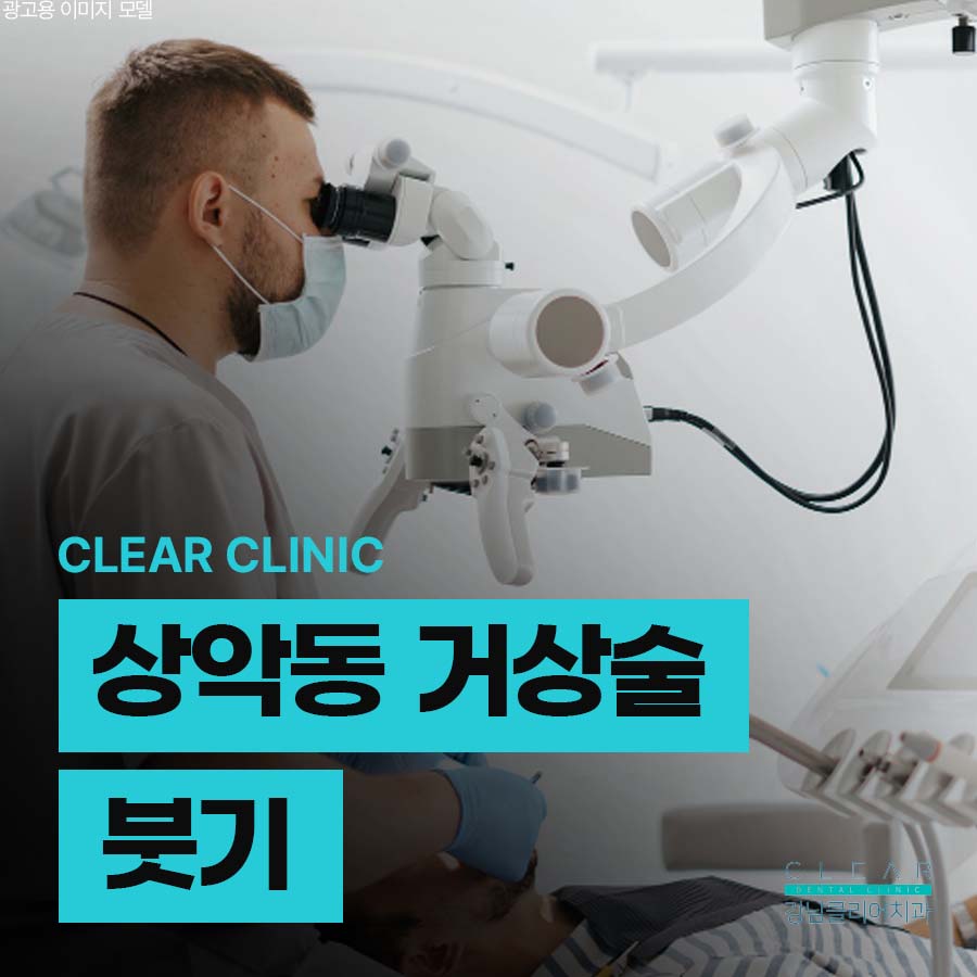상악동 거상술 붓기 부담을 줄이려면 관련 이미지 1
