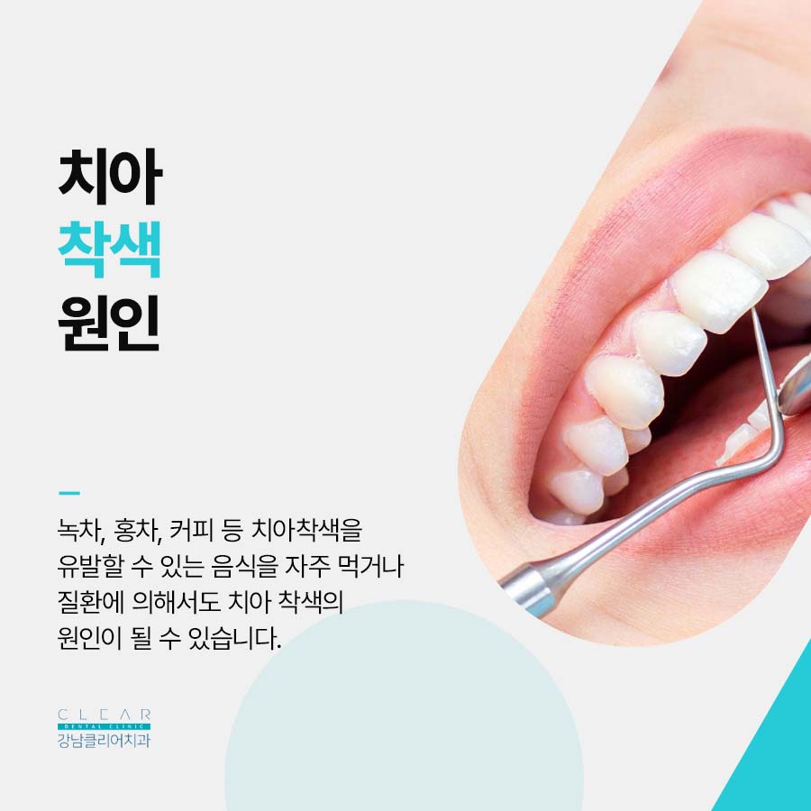 클리어치과 치아 착색 얼룩 제거 치료방법 관련 이미지 2