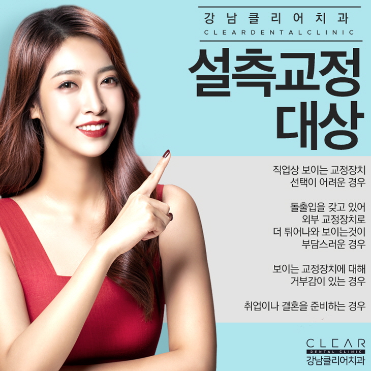 치아설측교정 안보이는 치아교정 맞춤형도 가능 관련 이미지 3