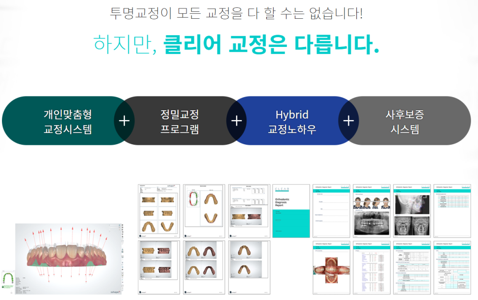 서울치아교정 잘하는 곳을 찾는 방법 관련 이미지 9