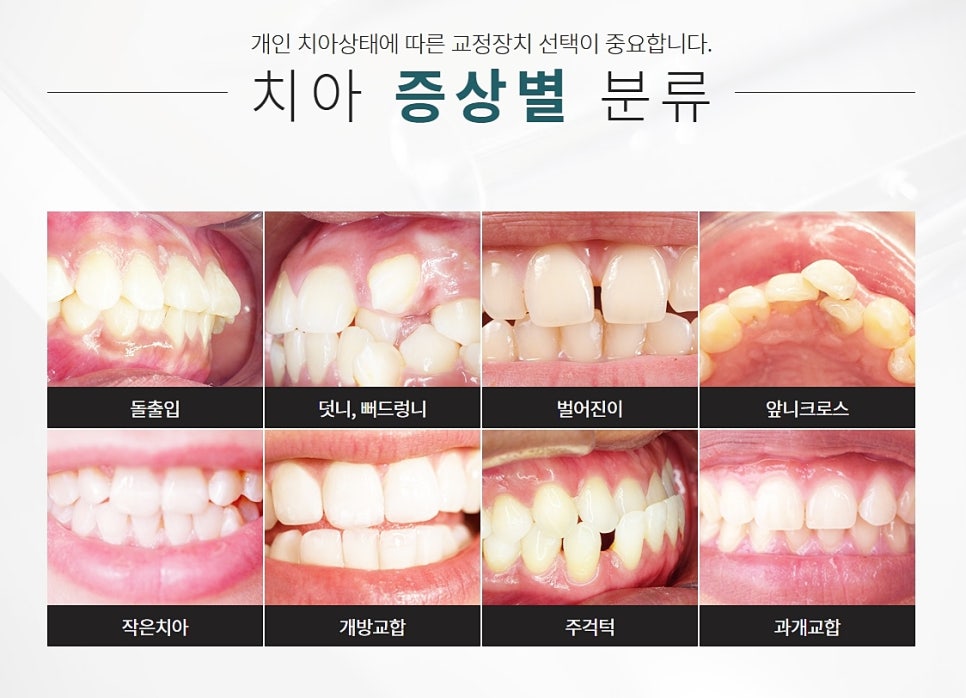 클리피씨의 장점 궁금했다면? 관련 이미지 4