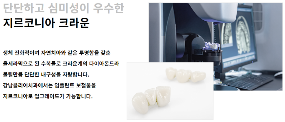 강남역임플란트 건강한 치아를 유지하기 위해서 관련 이미지 2