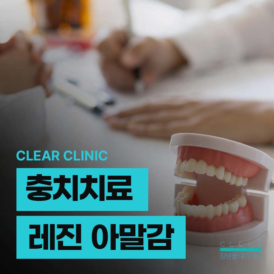 충치치료 레진 아말감 차이 비교점 관련 이미지 1
