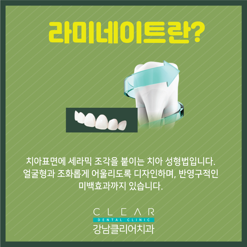 강남라미네이트 자연스러운 아름다움! 나노v컷 라미네이트 관련 이미지 2