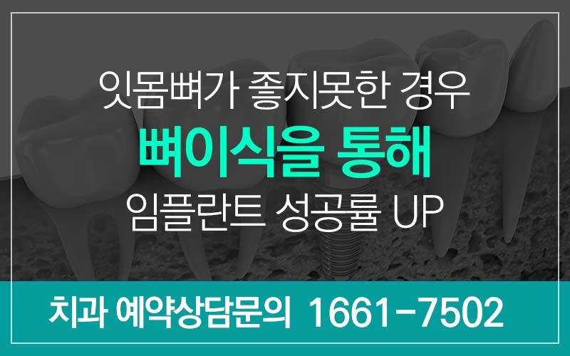 치과 뼈이식 임플란트 기간 과정 주의사항은? 관련 이미지 2