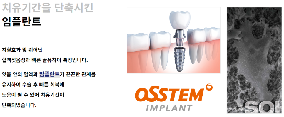 강남역임플란트치과 치아를 보다 오래 사용할 수 있도록 관련 이미지 4