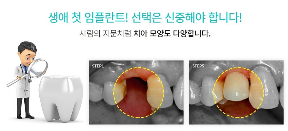 강남 임플란트 치과 집도의 역량을 파악하고 관련 이미지 5