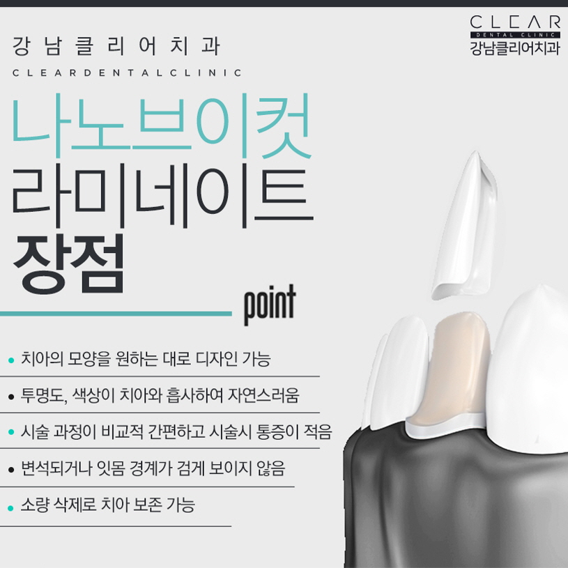 강남역 라미네이트 잘하는 치과 간단하고 효과적인 치료 관련 이미지 5