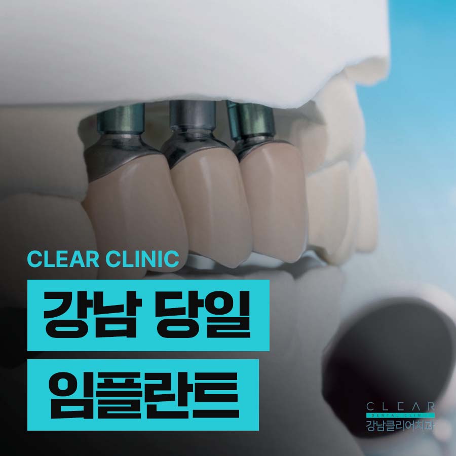 강남 당일 임플란트 전 미리 체크할 것은? 관련 이미지 1