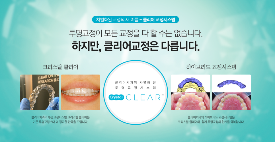 클리어 투명교정을 소개합니다. 관련 이미지 1