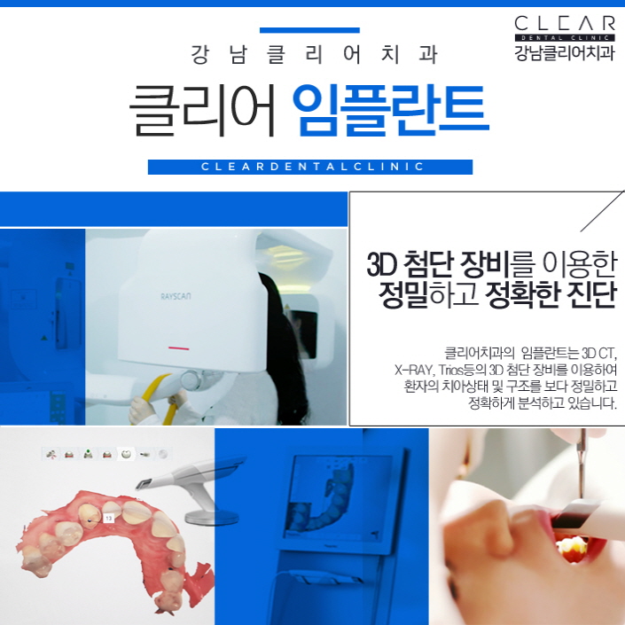 강남역임플란트치과 선택의 기준 관련 이미지 5