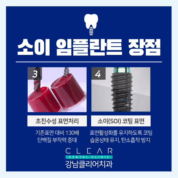강남임플란트잘하는치과 SOI(소이) 임플란트 첫 도입 이벤트 관련 이미지 4
