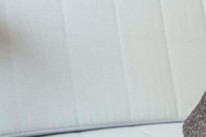 라미네이트 치아삭제 꼭 필요한 만큼만 해요 관련 이미지 18