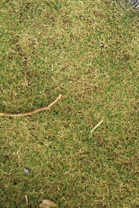 강남역 치과 임플란트 구조와 치료기간 관련 이미지 31