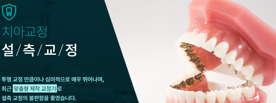 역삼동 부정교합 어떤 치료를 해야 할까? 관련 이미지 8