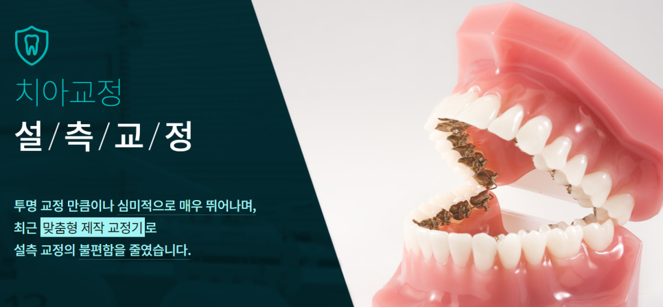 강남치아교정치과 다양한 방식으로 관련 이미지 4