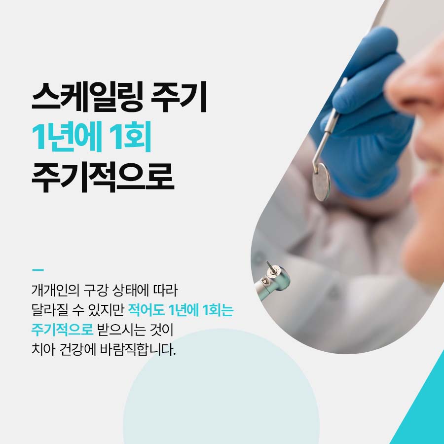 클리어치과 스케일링 주기 놓치지 말고 관련 이미지 3