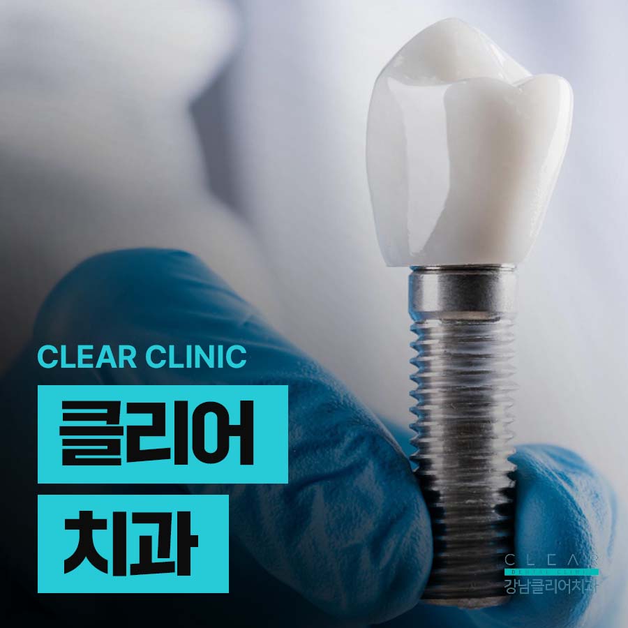 클리어치과 상악동거상술이 필요한 경우 관련 이미지 1