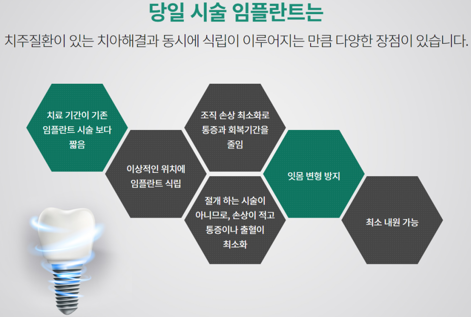 65세이상임플란트 맞춤형으로 빈틈없이 관련 이미지 7