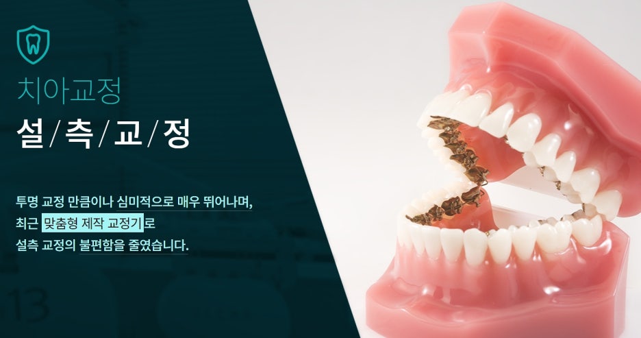 강남 설측교정 병원을 여기서 한다면? 관련 이미지 3